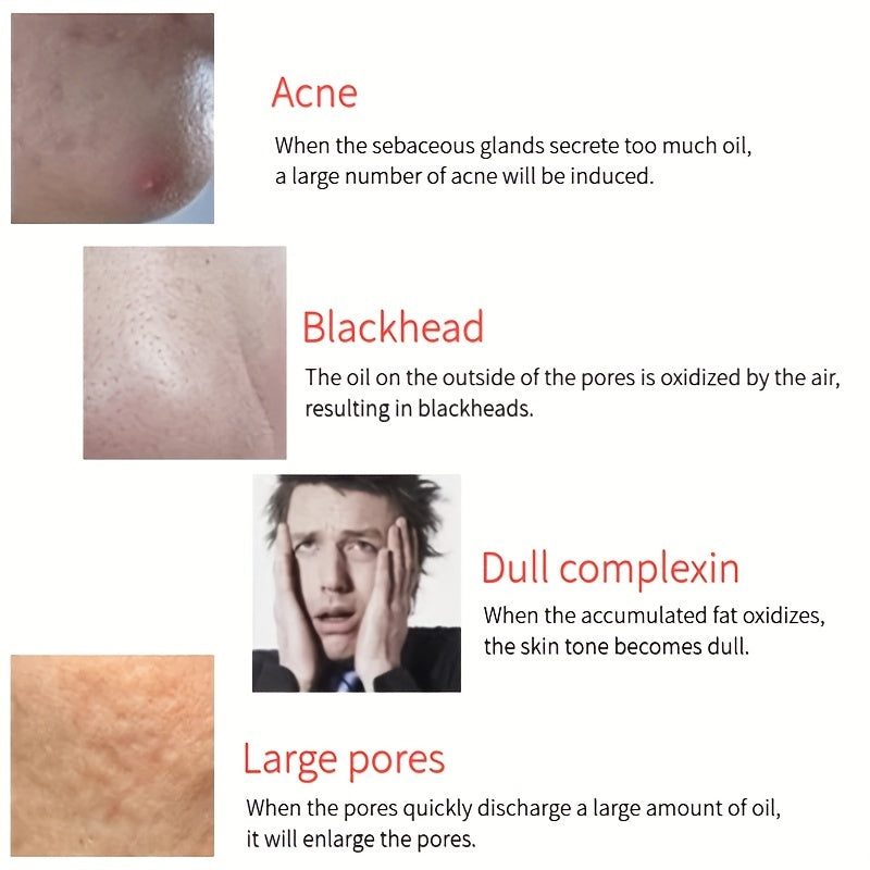 2 In 1 Oil Absorbing Volcanic Roller Volcanic Rolling Balls For Face Volcanic Stone Face Roller Portable Reusable Oil Control On The Go Instant Results Remove Excess Shine For Oily Skin