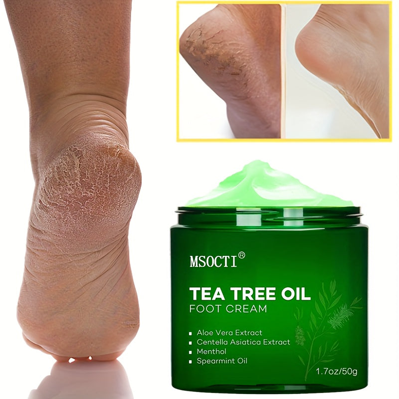 Athletes Foot Cream With Tea Tree Oil, Aloe & Spearmint - Hydrates, Softens & Conditions Dry Cracked Feet, Heel And Calluses,- Helps Soothe Irritated Skin